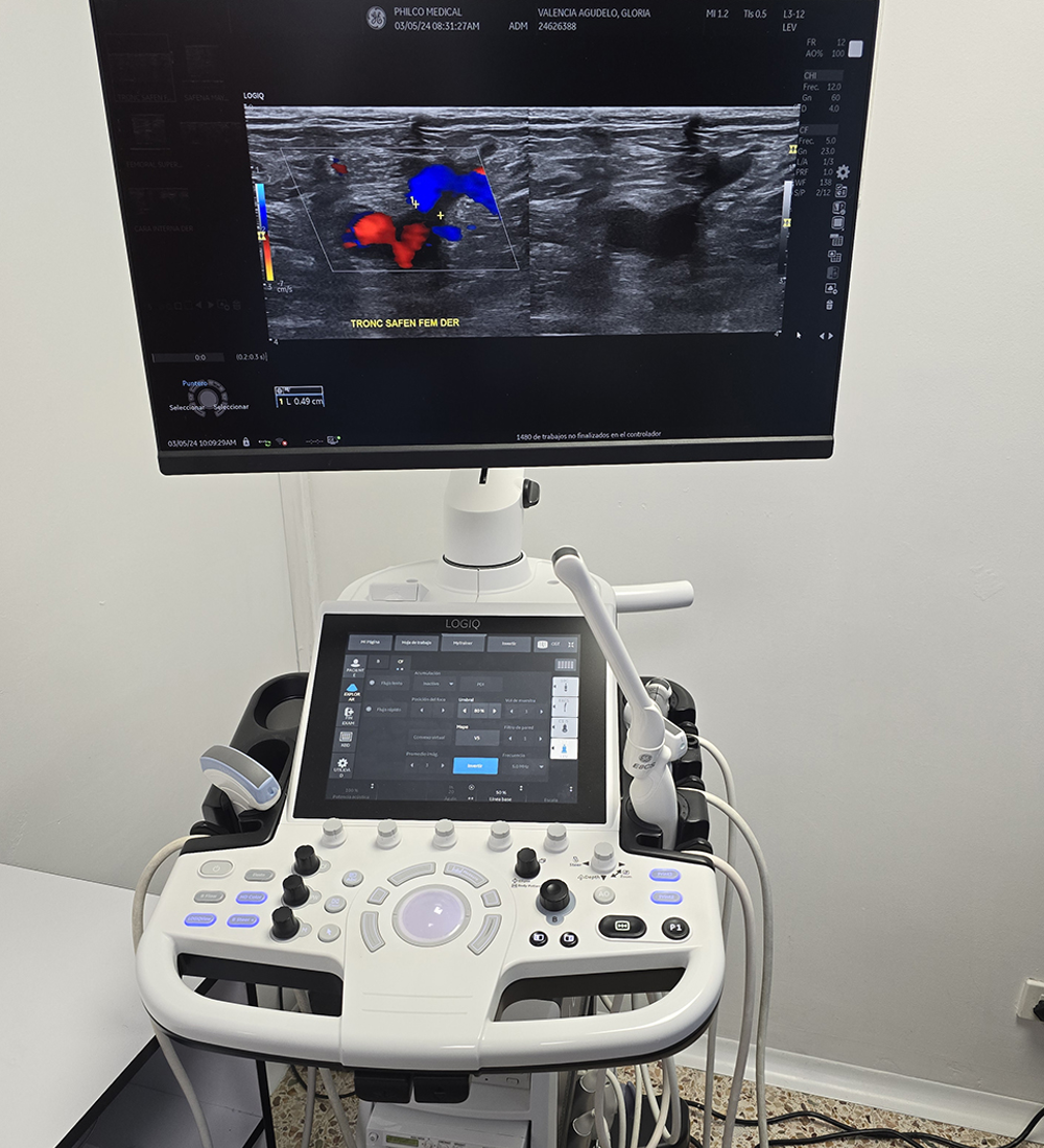 Atención y tecnología diagnóstica en Philco Medical Systems
